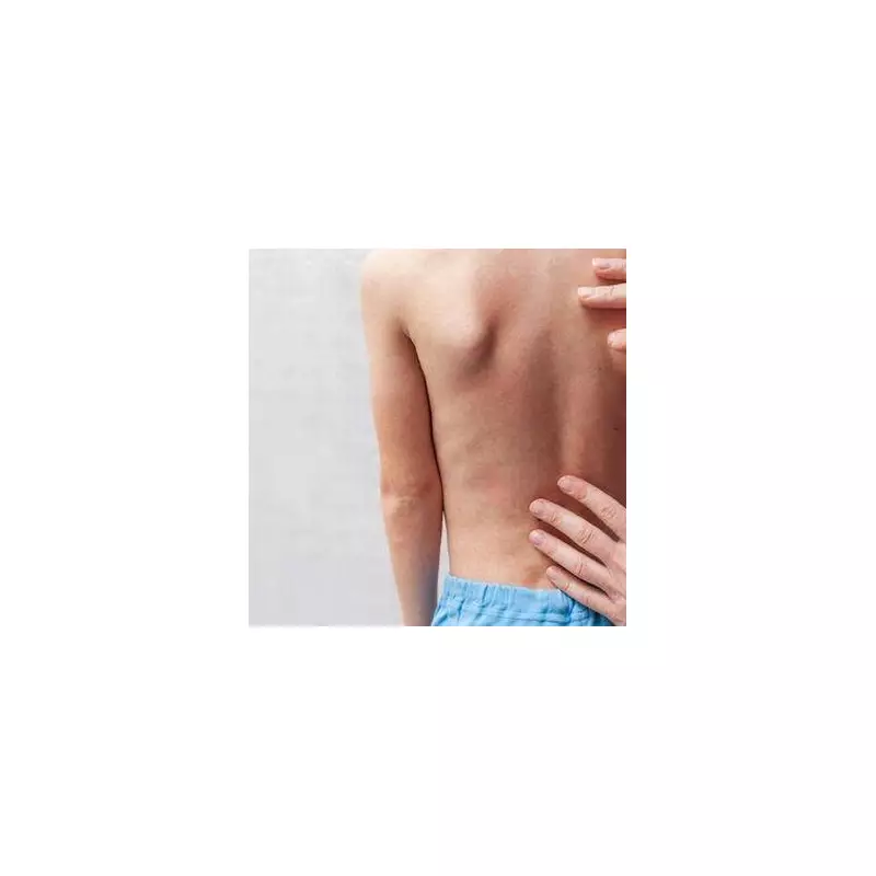 Measles Alert: UKHSA Warns of Virus 'Twice as Contagious as Common Cold'