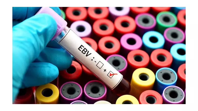 mRNA Vaccine Trial Targets Epstein-Barr Virus for MS Treatment