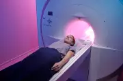 Private MRI Scans Now Bookable Without GP Referral