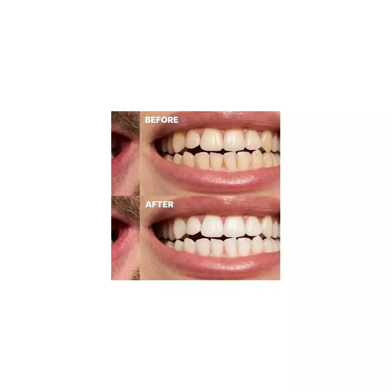 Amazon Deal: Nab 'Best Teeth Whitening Strips Ever' for Just £8.49