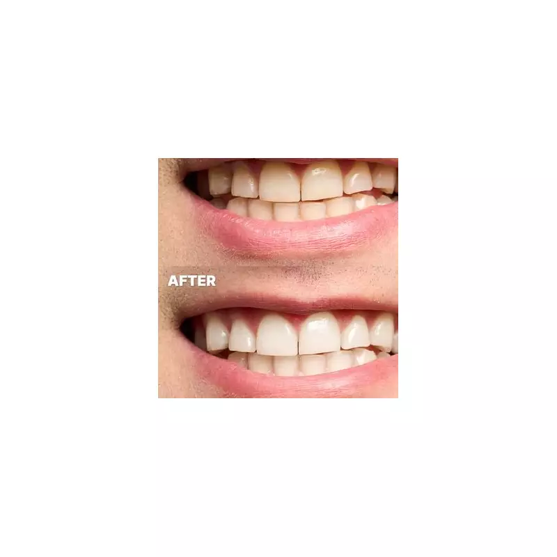 Amazon Shoppers Swap Expensive Whitening for 40p Strips, 7,000+ Sold