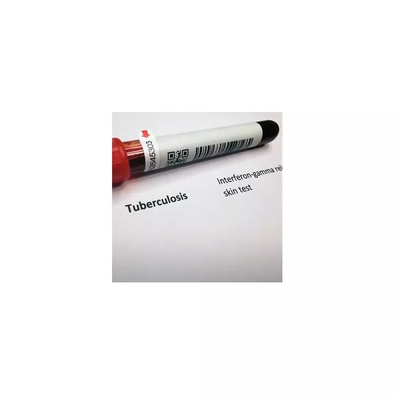 Birmingham Establishes Specialist Board to Combat Rising Tuberculosis Cases