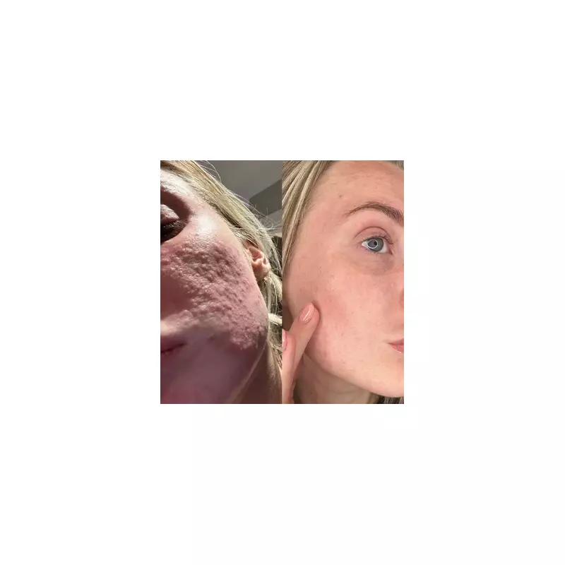 Dermatologist-Approved 47 Skin 'Changed My Life' in Winter Sale, Shoppers Say