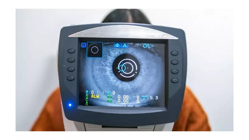 Glaucoma Crisis: 1.1 Million Brits at Risk as 'Silent Thief' of Sight Cases Set to Soar