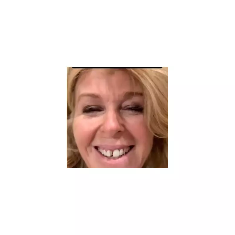 Kate Garraway's Teeth Fall Out After Taxi Collision: GMB Host's Dental Drama