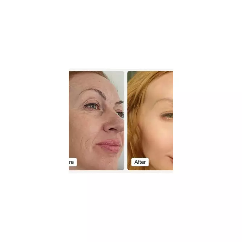 Save £400 on LED Face Mask with 80% Off Partner Deal