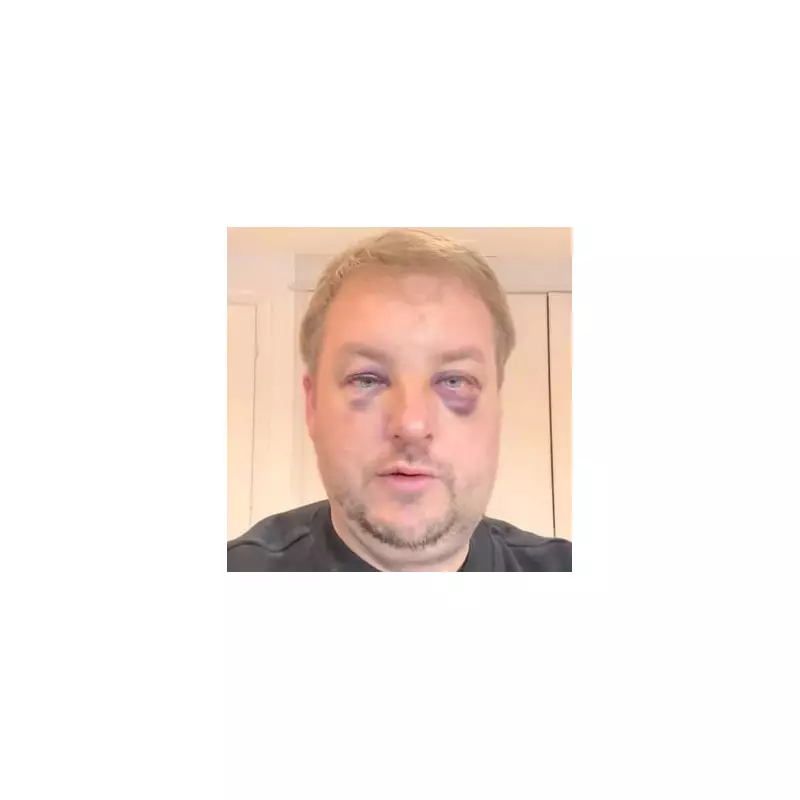 Stafford Businessman Recounts Terrifying 25-Second Showroom Assault