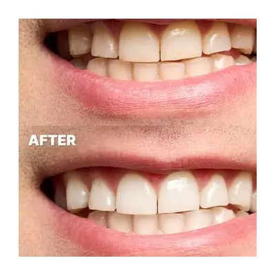 Amazon Shoppers Swap Expensive Whitening for 40p Strips, 7,000+ Sold