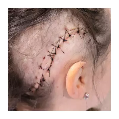 Antiques Roadshow's Theo Burrell Shares Surgery Scar Photo in Glioblastoma Update