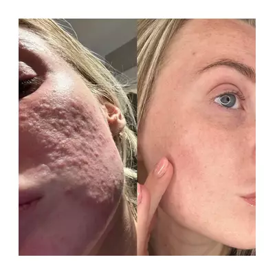 Dermatologist-Approved 47 Skin 'Changed My Life' in Winter Sale, Shoppers Say