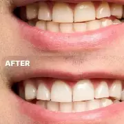 Amazon Shoppers Swap Expensive Whitening for 40p Strips, 7,000+ Sold