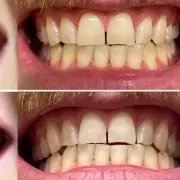 Science-Backed £20 Teeth Whitening Strips Brighten Smiles by 10 Shades