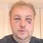 Stafford Businessman Recounts Terrifying 25-Second Showroom Assault