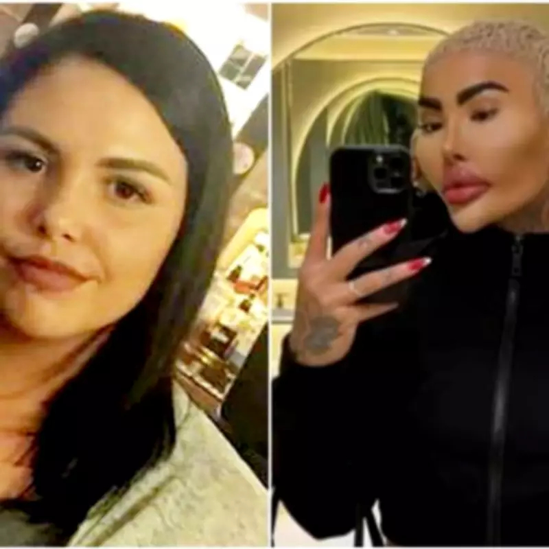 Family Demands Brazilian Butt Lift Ban After Mum's Death Linked to 'Lip King'
