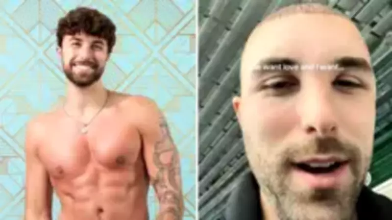 Love Island's Zac Woodworth Reveals Hair Transplant Journey