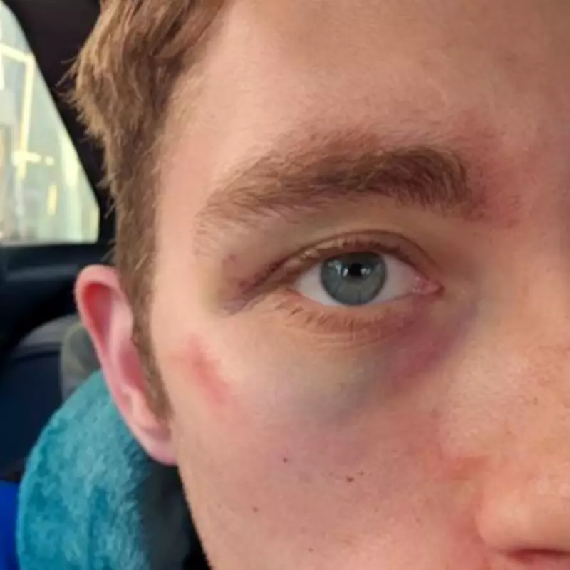 Man Left 'Looking Dead' After Brutal Pub Attack in Stourbridge