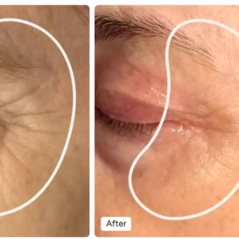 Red Light Therapy Eye Mask Garners Praise for Anti-Ageing Results