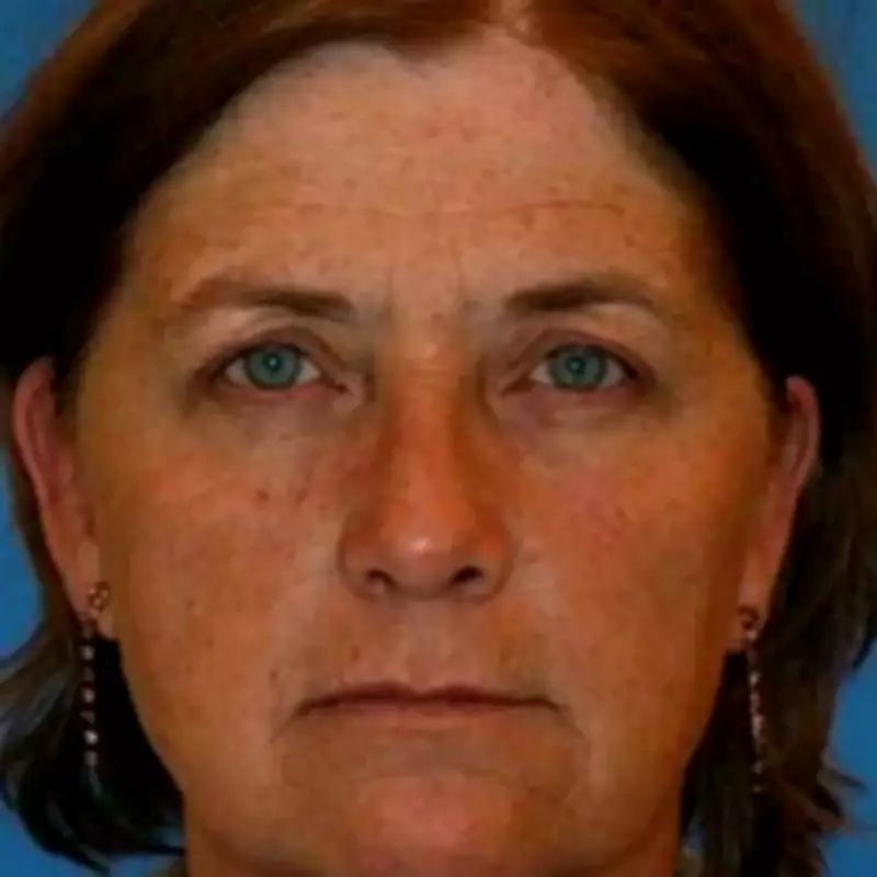 Smoking Twin Study Reveals Dramatic Ageing Gap in Identical Siblings