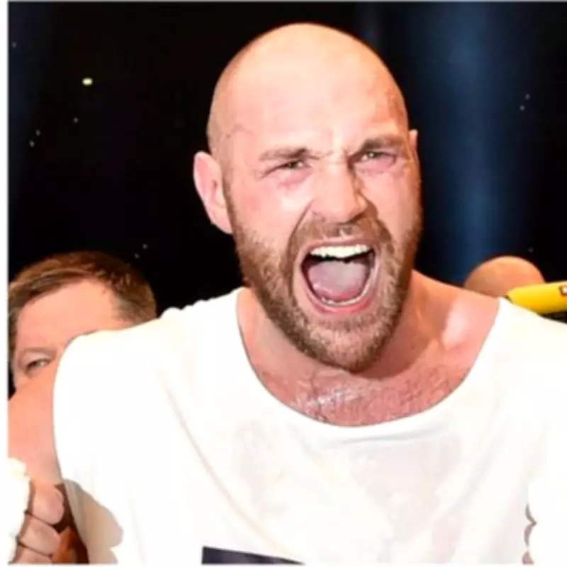 The Bare-Knuckle Legacy: How Tyson Fury's Ancestor Bartley Gorman Became King of the Gypsies