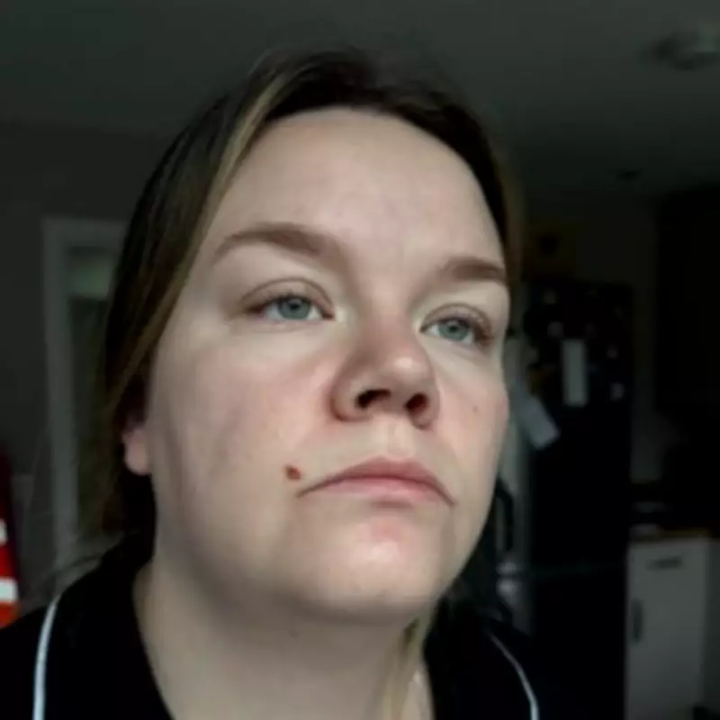 Walsall Mother Awarded £10,000 Compensation After Dental Procedure Causes Facial Burn