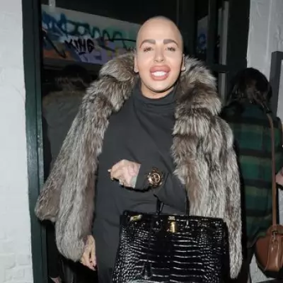 Midlands 'Lip King' Reality Star Jordan James Parke Dies Aged Unknown