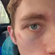 Man Left 'Looking Dead' After Brutal Pub Attack in Stourbridge