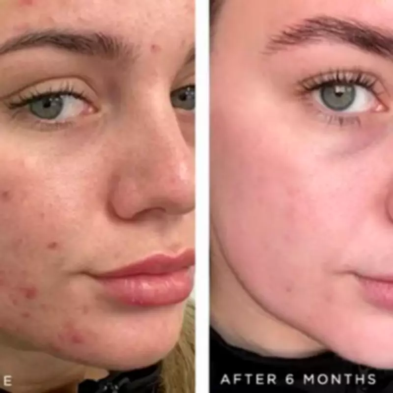 Dr Sam's £20 'Holy Grail' Cleanser Transforms Skin with 4,500 Five-Star Reviews