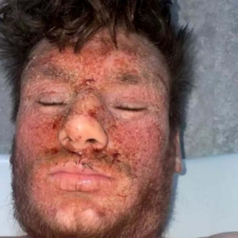 Father's Agony: Missed Daughter's Birth After Steroid Cream Withdrawal