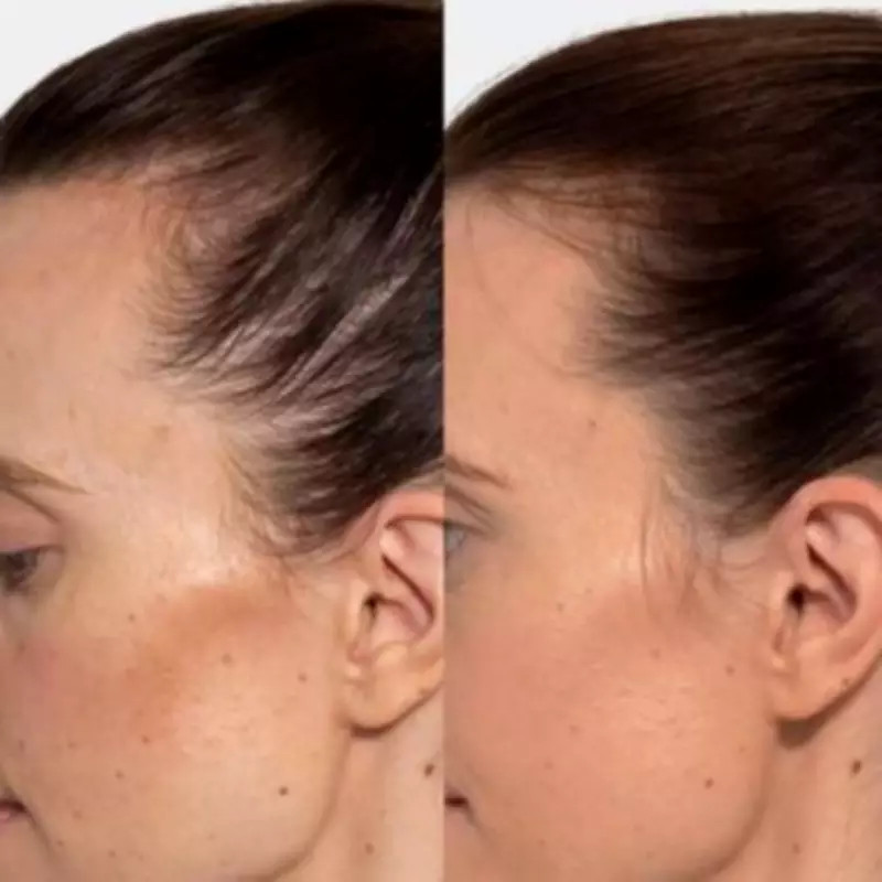 Woman 'Shocked' by Rapid Hair Growth After Using £34 Serum