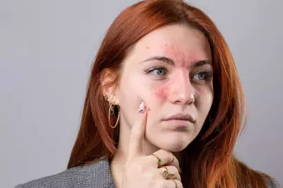 Beauty Editor's Quest: Clinique Cream to Combat Persistent Facial Redness