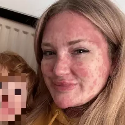 Measles Outbreak Leads to Unexpected Pregnancy After Contraceptive Patch Removal