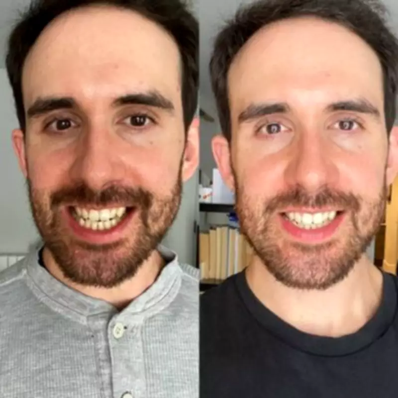 27p-a-Day Dentist-Approved Teeth Whitening Kit Saves Shoppers Hygienist Visits