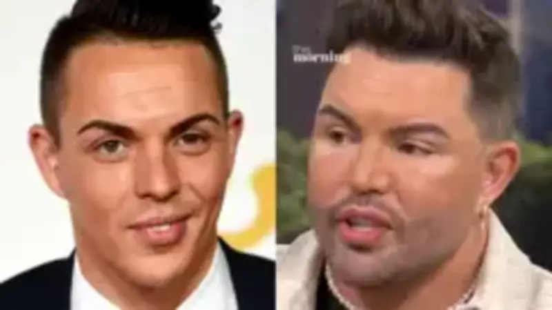 Bobby Norris Reveals Real Reason for Facelift in Emotional Interview