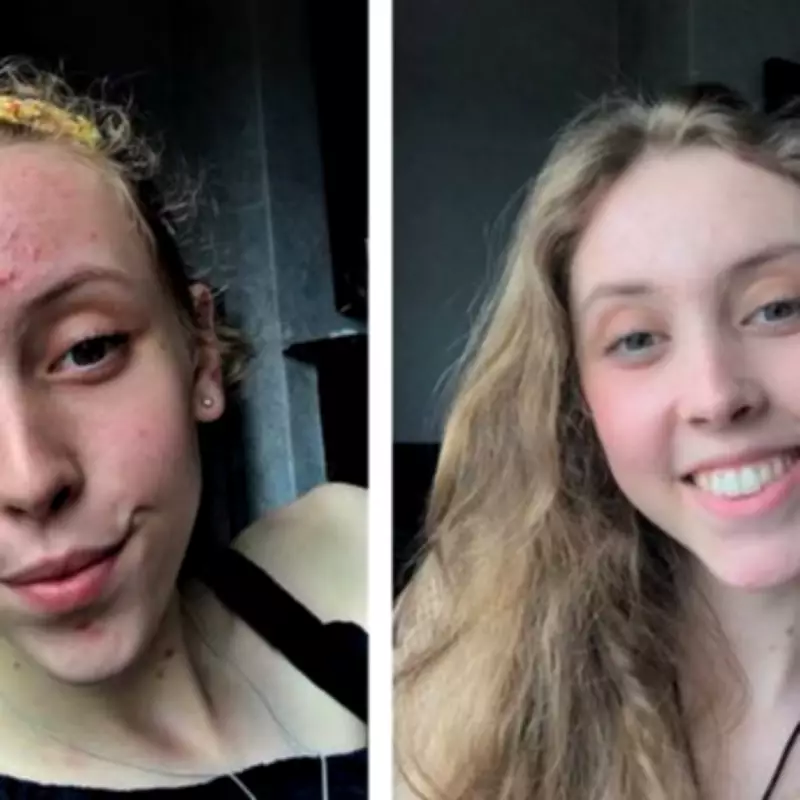 Brides-to-be praise £16 'miracle' acne serum as wedding skincare solution