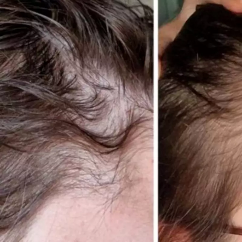 Hair Saviour Supplement Gains Popularity for Promoting Hair Growth and Reducing Shedding