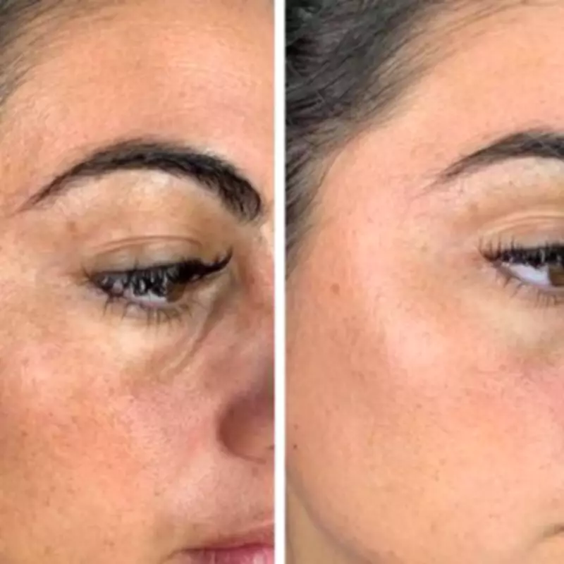 LED Face Mask with £219 Off Leaves Skin Youthful, Shoppers Say