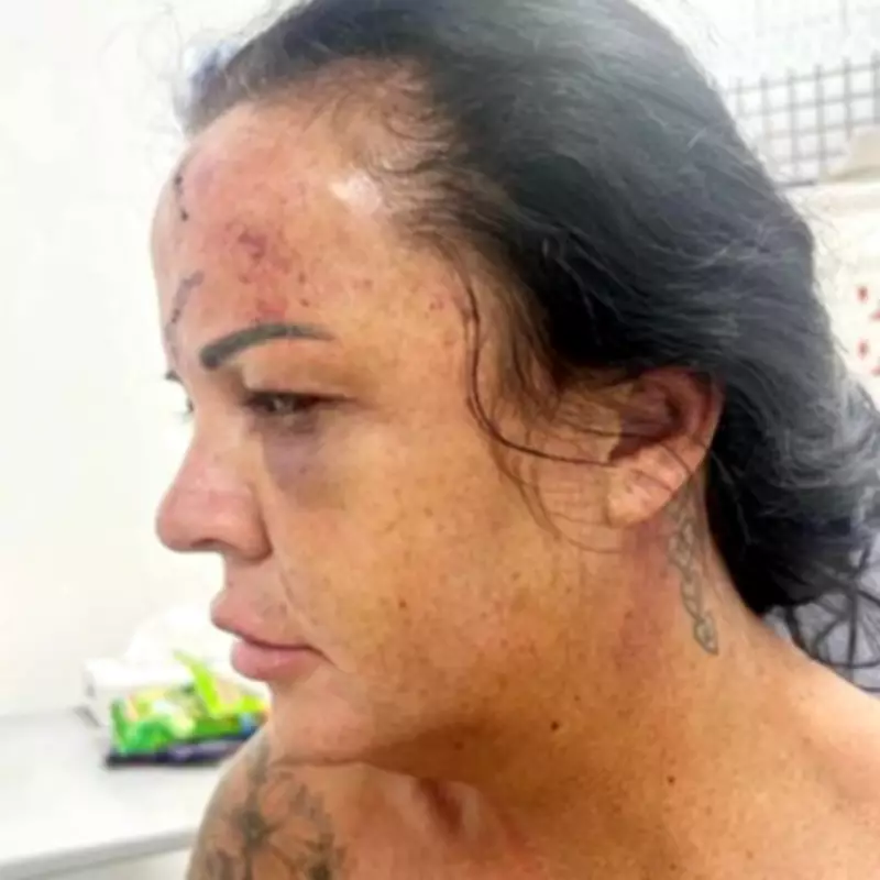 Midland Mother Reveals Scars After Fiancé's Near-Fatal Assault
