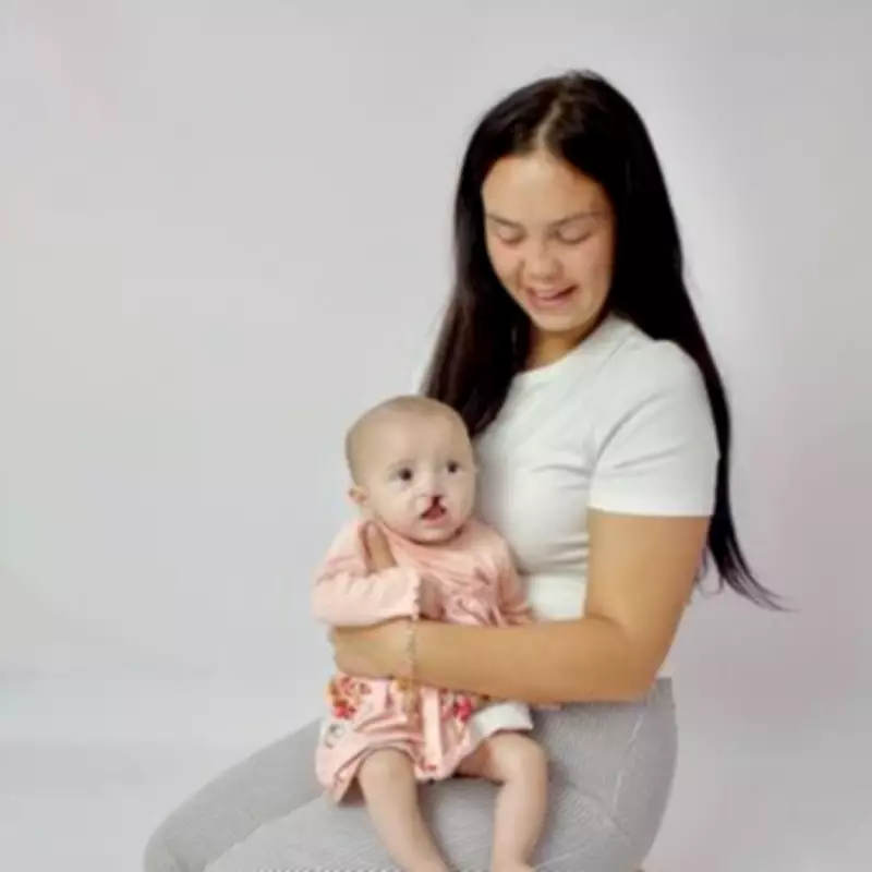 Tamworth mum wrote children's book after baby's cleft lip surgery