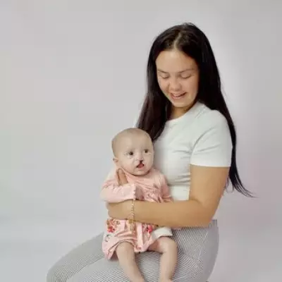 Tamworth mum wrote children's book after baby's cleft lip surgery