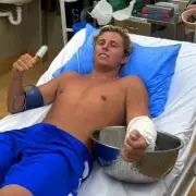 Australian surfer survives near-fatal box jellyfish sting in Fiji waters