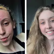 Brides-to-be praise £16 'miracle' acne serum as wedding skincare solution