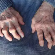 DWP Sends £458 Attendance Allowance to State Pensioners in May