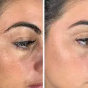 LED Face Mask with £219 Off Leaves Skin Youthful, Shoppers Say