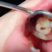 West Midlands Dentist Reveals Children Missing Dental Check-Ups for Years