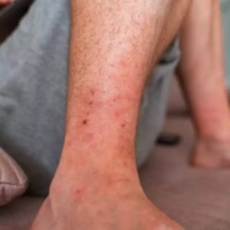 DWP to Pay £459 to 30,000 People with 24 Skin Conditions