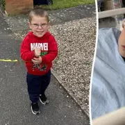 Boy, 5, Left with Hole in Skull After E-Scooter Collision