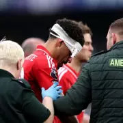 Gibbs-White Injury Update: Mask Made for Aston Villa Clash