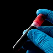 Home Blood Tests Launch in Birmingham as Healthy Life Expectancy Hits 57 Years