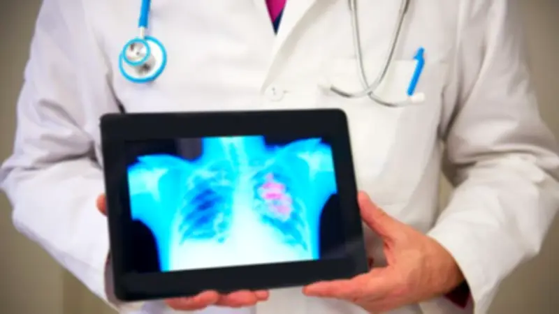 AI Rollout Across NHS to Speed Up Cancer Diagnoses by 2029