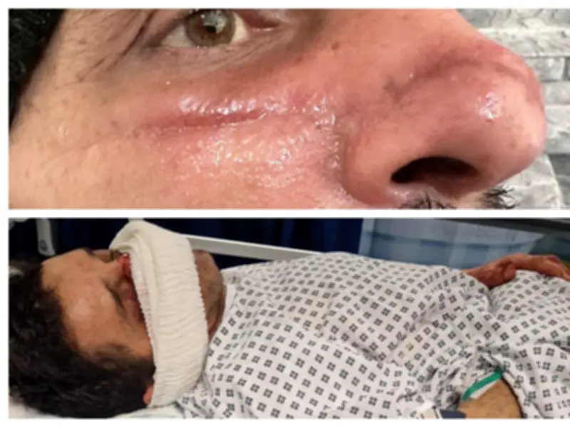 Father slashed across face in Perry Barr phone mugging ordeal